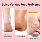 USB Rechargeable Electric Foot Care Callus Remover Nail Grinder Professional Foot Care File with replacement sandpaper tray