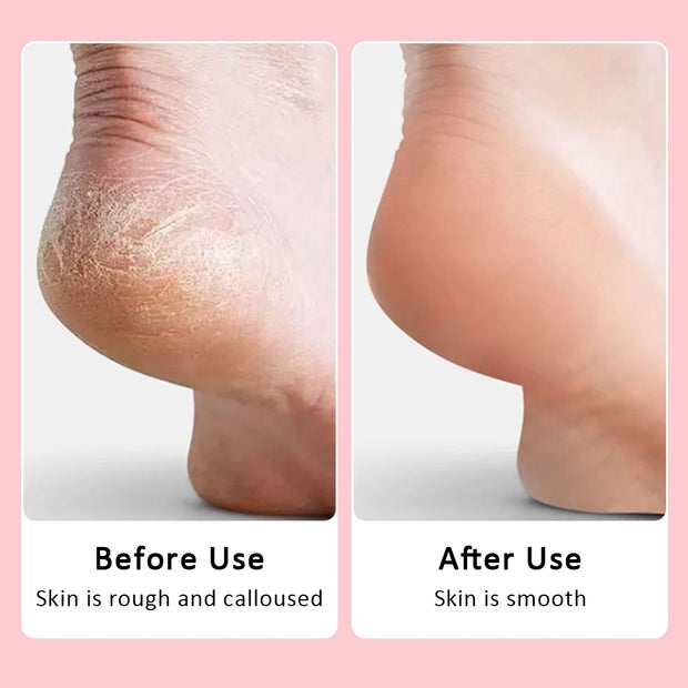 USB Rechargeable Electric Foot Care Callus Remover Nail Grinder Professional Foot Care File with replacement sandpaper tray